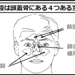 鼻づまりの原因は副鼻腔にある